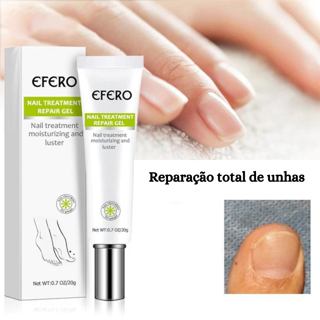 Pomada Efero Anti Fungos Unhas Encravadas |COMPRE 1 LEVE 2| Frete Grátis