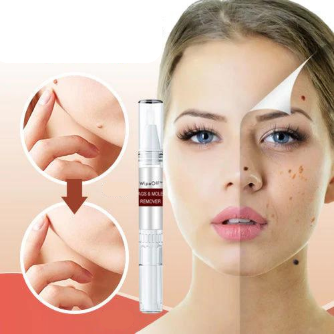 Removedor de Verrugas WipeOff™ |COMPRE 1 LEVE 3| + Frete Grátis