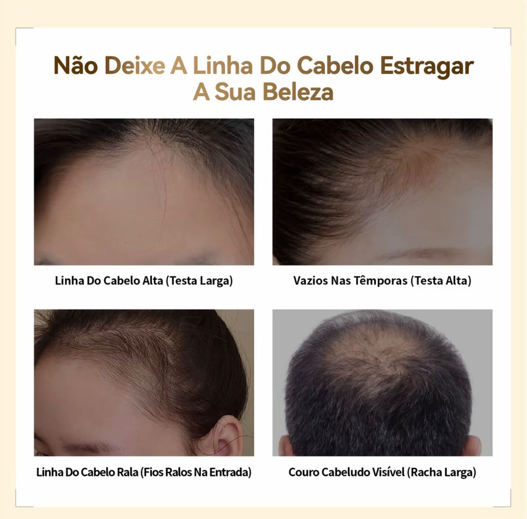 Densité Pó de Preenchimento Capilar